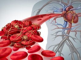 Trombolitik Tedavi: Kime, Ne Zaman, Nasıl?