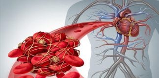 Trombolitik Tedavi: Kime, Ne Zaman, Nasıl?