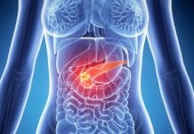 Akut Pankreatit ve Yönetimi