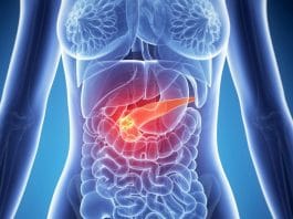 Akut Pankreatit ve Yönetimi