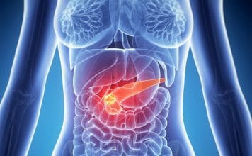 Akut Pankreatit ve Yönetimi