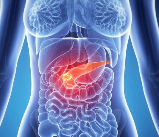 Akut Pankreatit ve Yönetimi