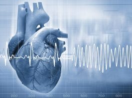 Ventriküler Fibrilasyon (VF)