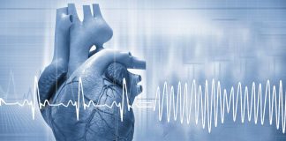 Ventriküler Fibrilasyon (VF)