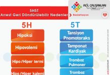 Arrest Geri Döndürülebilir Nedenler 6H 6T (5H5T) Akıl Kartı