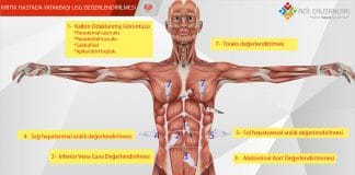 Kritik Hastada Yatakbaşı USG Değerlendirilmesi Akıl Kartı