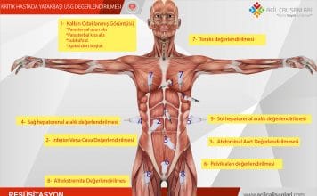 Kritik Hastada Yatakbaşı USG Değerlendirilmesi Akıl Kartı