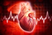 Wellen Sendromu Olgu Sunumu