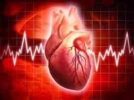 Wellen Sendromu Olgu Sunumu