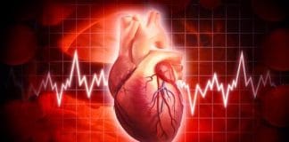 Wellen Sendromu Olgu Sunumu