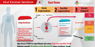 Akut Koroner Sendrom Karar Verme