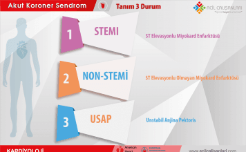 Akut Koroner Sendrom Tanım Akıl Kartı