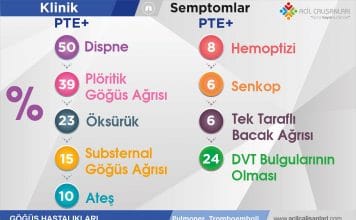 Pulmoner Tromboemboli Akılkartı