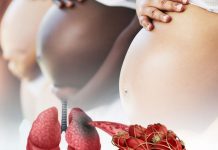Gebelikte Pulmoner Tromboemboliye Acil Yaklaşım
