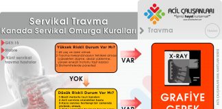 Kanada Spinal Kuralları Servikal Yaralanmalar Akıl Kartı