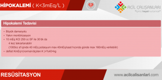 Hipopotasemi (Hipokalemi) Akıl Kartı