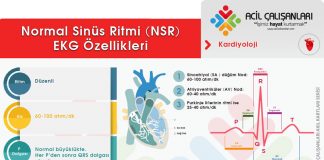 Normal Sinüs Ritmi (NSR)