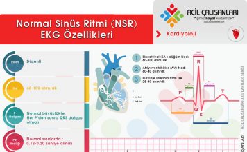 Normal Sinüs Ritmi (NSR)