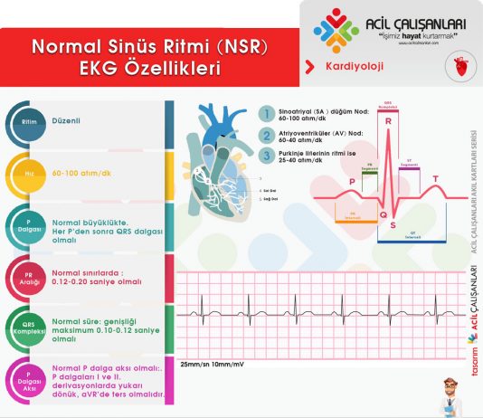 Normal Sinüs Ritmi (NSR)