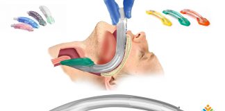 Supraglottik Araçlar Alternatif Havayolu