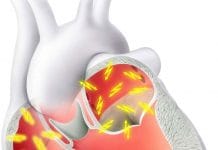Atriyal Fibrilasyon Acil Servis Yönetimi