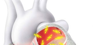 Atriyal Fibrilasyon Acil Servis Yönetimi