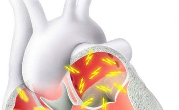 Atriyal Fibrilasyon Acil Servis Yönetimi