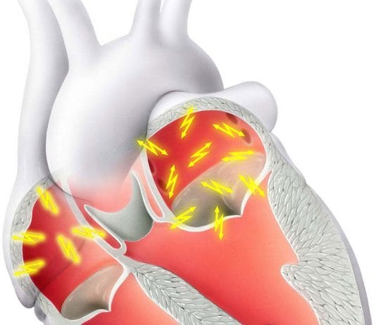 Atriyal Fibrilasyon Acil Servis Yönetimi