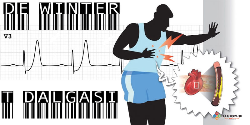 De Winter EKG Paterni Banner