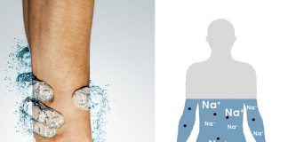 Hiponatremi Acil Yaklaşım