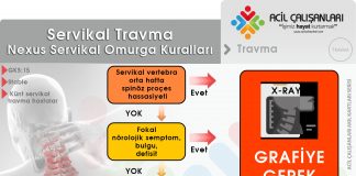 Nexus Kriterleri Servikal Yaralanmalar Akıl Kartı