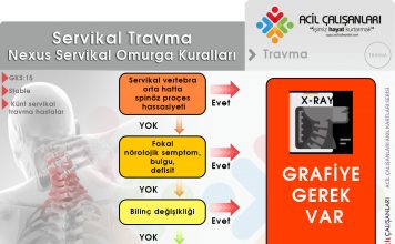 Nexus Kriterleri Servikal Yaralanmalar Akıl Kartı
