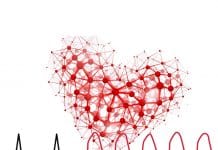 Ventriküler Taşikardi (VT)