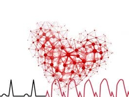 Ventriküler Taşikardi (VT)