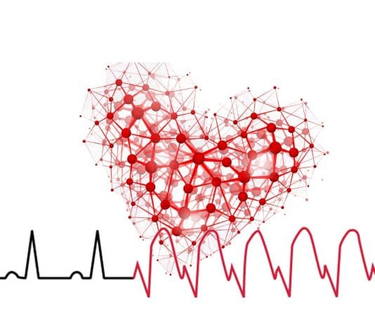 Ventriküler Taşikardi (VT)