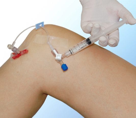 Proksimal Tibia İntraosseöz Girişim Uygulama