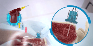 İntraosseöz ( İO / Kemik İçi ) Yol Açılması