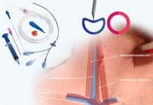 Santral Venöz Kateterizasyon