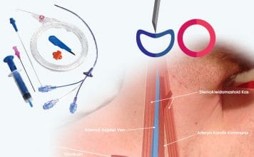 Santral Venöz Kateterizasyon