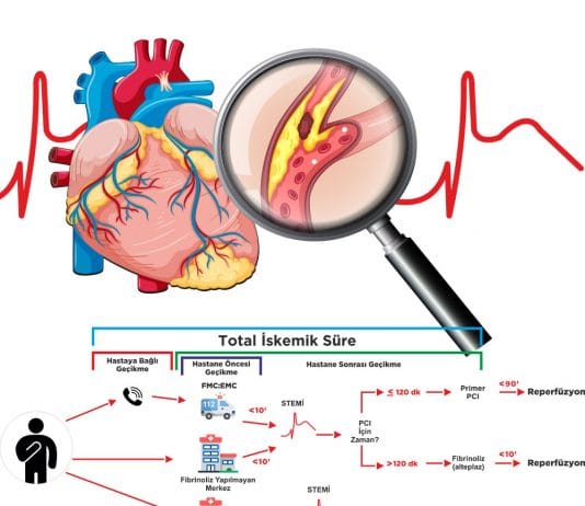 Anterior Miyokard İnfarktüsü