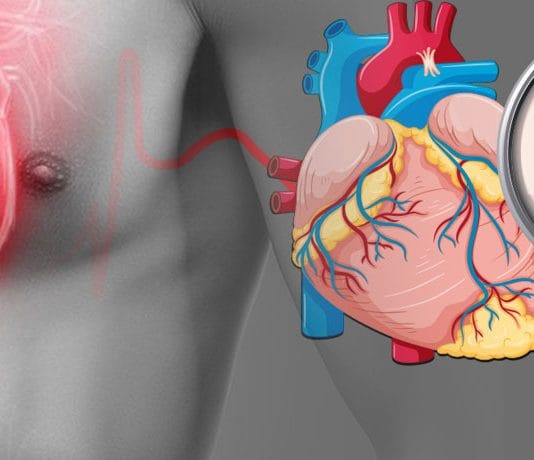 İnferior Miyokard İnfarktüsü