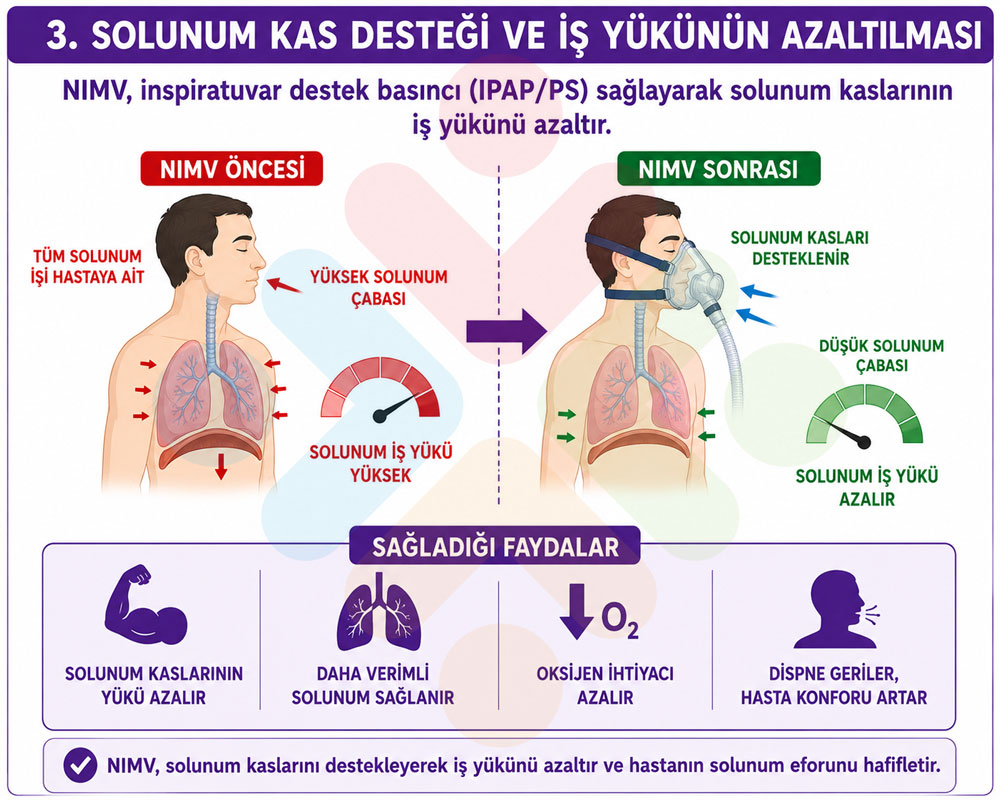 Solunum kaslarının desteklenmesi
