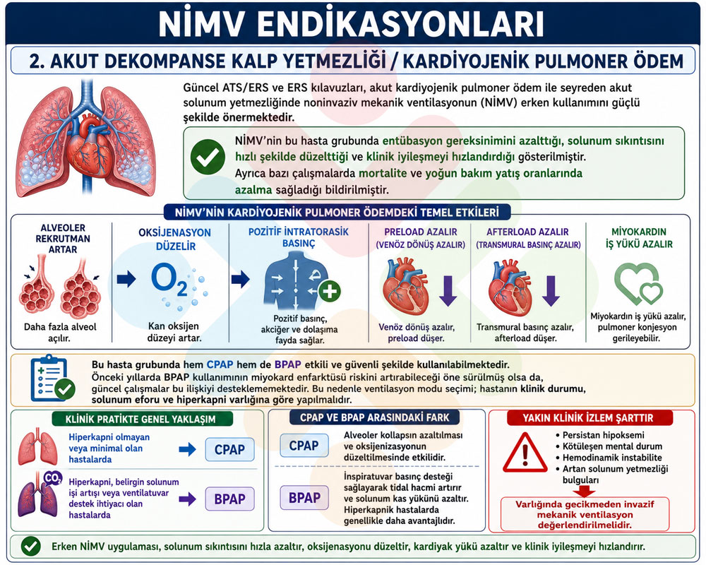 Kardiyojenik pulmoner ödemde NIMV