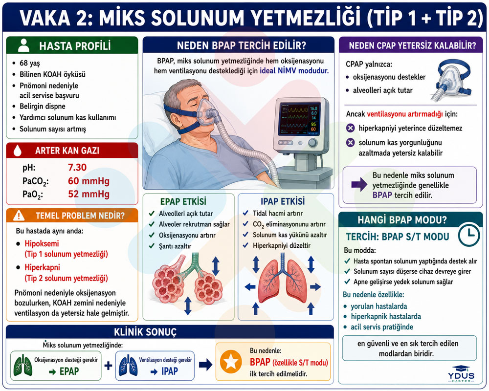 Vaka 2 miks solunum yetmezliği