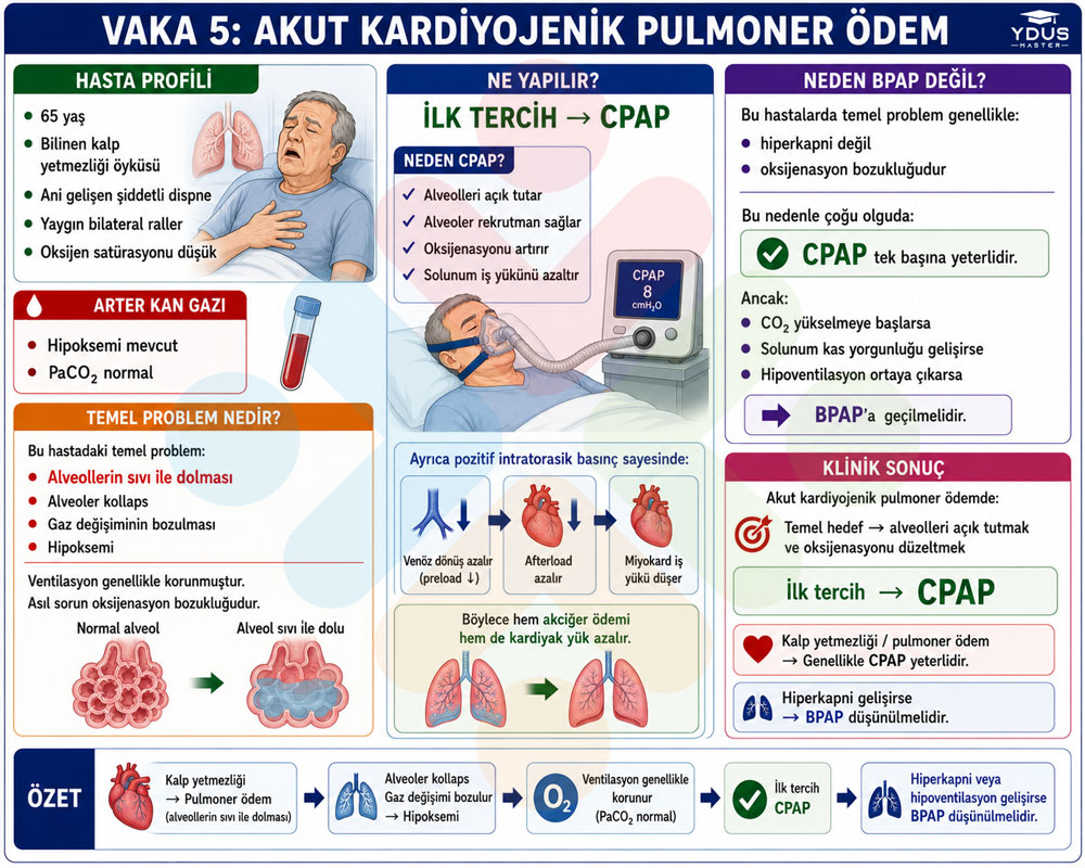 Vaka 5 pulmoner ödem CPAP