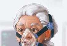 Non İnvazif Mekanik Ventilasyon Uygulaması (NIMV)