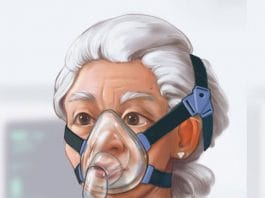 Non İnvazif Mekanik Ventilasyon Uygulaması (NIMV)