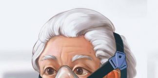 Non İnvazif Mekanik Ventilasyon Uygulaması (NIMV)