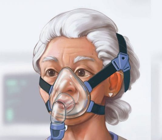 Non İnvazif Mekanik Ventilasyon Uygulaması (NIMV)