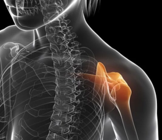 Anterior Omuz Çıkığı